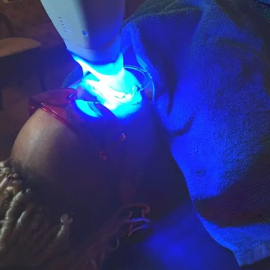 A LaBrows teeth whitening session in progress